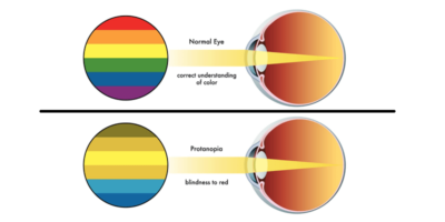Penyakit Buta Warna Total vs Buta Warna Parsial • Deherba.com