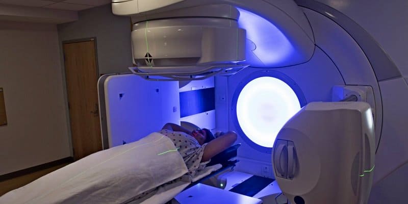 Radioterapi Kanker Eksternal