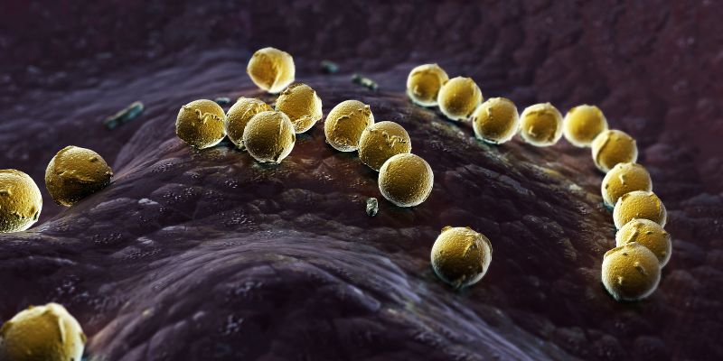 Ilustrasi Streptococcus pyogenes, bakteri penyebab tonsilitis