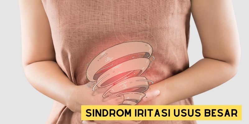 Ilustrasi Sindrom Iritasi Usus (IBS)